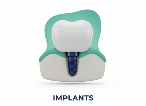 Implants & Full-Arch Solutions