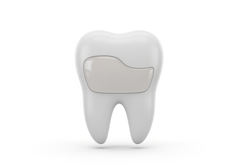 Smile Design (Veneers & Crowns)