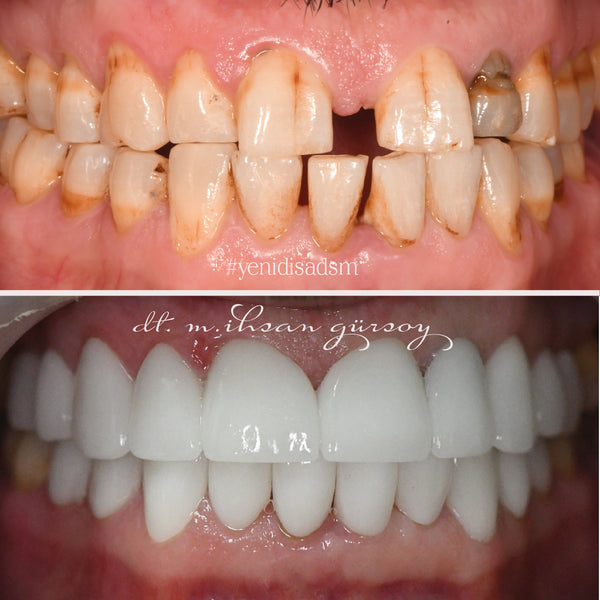 Before treatment