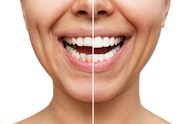 Dental Treatments & Fillings